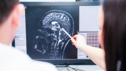 Brain tumors vanish in mice after Israeli study finds and destroys ‘power source’